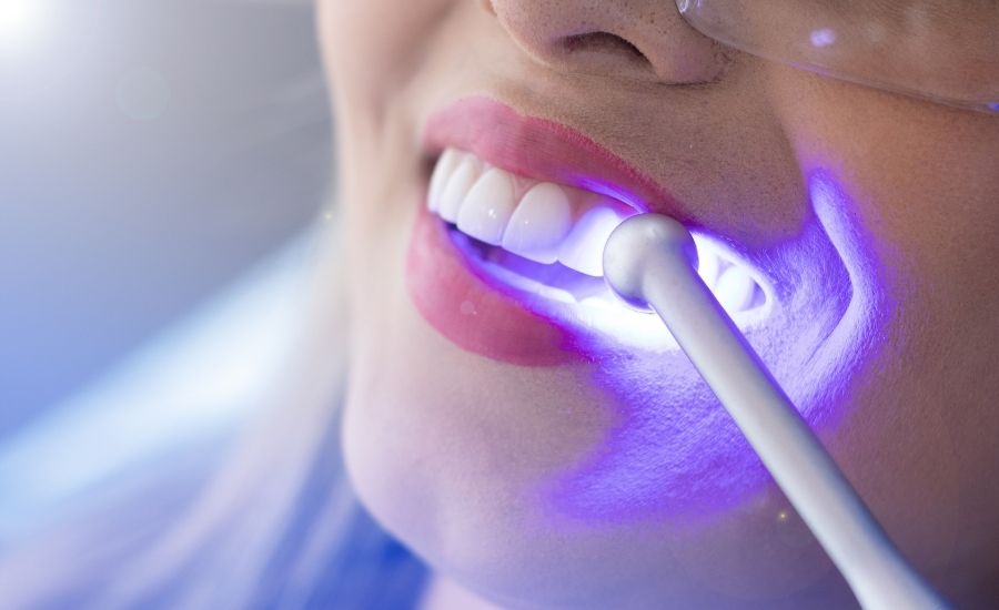 Teeth Whitening Turkey